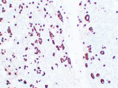 Anti -ACTH Mouse mAb