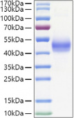Active Recombinant Human TGFR-1/ALK-5 Protein (RP01408)