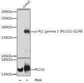 Phospho-PLCG1-S1248 Antibody kit (RK04096)