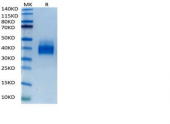Biotinylated Recombinant Human B7-H1/PD-L1/CD274 Protein (RP02473)