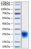 Active Recombinant Human Cripto-1/TDGF1 Protein (RP00202)