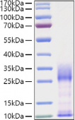 Recombinant Mouse IL-3 Protein (RP01386)