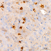 β-Amyloid(1-42) Rabbit mAb (A24422)