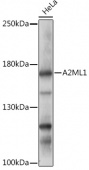 A2ML1 Rabbit pAb (A17831)
