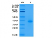 Biotinylated Recombinant Human TNFRSF5/CD40 Protein (RP02308)