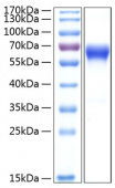 Active Recombinant Human TNFRSF9/4-1BB/CD137 Protein (RP00276)