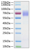 Recombinant Human MSR1/CD204 Protein (RP01033)