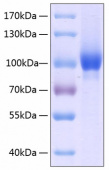 Active Recombinant Human Neuropilin-1/NRP1/VEGF165R/CD304 Protein (RP00137)