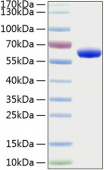 Active Recombinant Human Erythropoietin R/EPO-R Protein (RP00111)