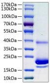 Recombinant Human IL-4 Protein (RP00995)