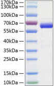 Active Recombinant Human Siglec-15/CD33L3 Protein (RP01187)