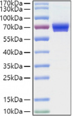 Recombinant Human IL-2-RA/CD25  Protein (RP01405)
