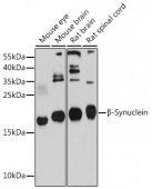β-Synuclein Rabbit pAb (A10443)