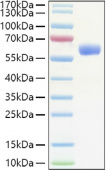 Active Recombinant Human Erythropoietin/EPO Protein (RP01380)