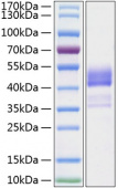 Recombinant Human TNFRSF13C/BAFF-R/CD268 Protein (RP01223)