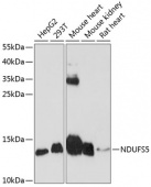 [One Step] NDUFS5 antibody Kit (RK05735)