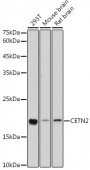 [KO Validated] CETN2 Rabbit pAb (A5397)