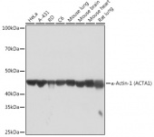 α-Actin-1 (ACTA1) Rabbit mAb (A2280)