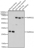 TMPRSS2 Rabbit pAb (A1979)