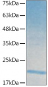 Recombinant Human IL-21 Protein (RP02508)