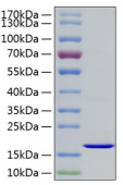 Recombinant Human FGF-2/bFGF Protein (RP01042)
