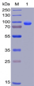Recombinant Human Syndecan-1/SDC1/CD138 Protein (RP02239)