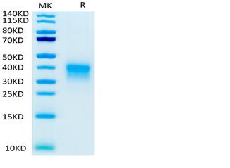 Biotinylated Recombinant Human B29/CD79B Protein (RP02313)