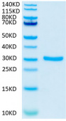 Recombinant Cynomolgus TNFRSF17/BCMA/CD269 Protein (RP02009)