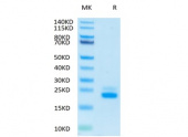 Recombinant Human TRAIL-R2/CD262 Protein (RP02084)