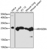 [One Step]ARHGDIA Antibody Kit (RK05623)