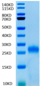 Recombinant Human TNFRSF18/CD357 Protein (RP02007)