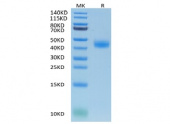 Recombinant Cynomolgus IL-2RB/CD122 Protein (RP02292)
