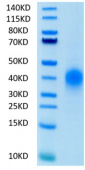 Recombinant Human BTLA Protein (RP02018)