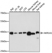 [One Step]AKR1A1 Antibody Kit (RK05620)
