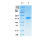 Recombinant Human IL-2RB/CD122 Protein (RP02293)