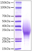Recombinant Mouse IL-18BP Protein (RP01531)