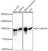 β-Catenin Mouse mAb (A20221)
