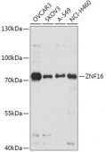 ZNF16 Rabbit pAb (A17548)