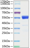 Active Recombinant Mouse IFN-gamma Protein (RP01070)