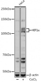 Антитела поликлональные кроличьи к HIF1α (HIF1α Rabbit pAb), ABclonal