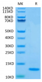 Recombinant Human TGF-beta 2 Protein (RP02069)