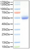 Recombinant Mouse IL-5RA/CD125 Protein (RP01473)