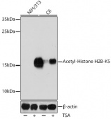 Acetyl-Histone H2B-K5 Rabbit pAb (A15621)