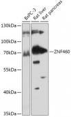 ZNF460 Rabbit pAb (A17621)