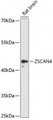 ZSCAN4 Rabbit pAb (A12016)