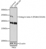 [KO Validated] Integrin beta 4 (ITGB4/CD104) Rabbit pAb (A19890)