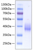 Recombinant Human Coagulation factor III/CD142 Protein (RP00112)
