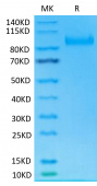 Recombinant Human IL-23R Protein (RP02421)