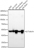 β-Tubulin Rabbit mAb (A12289)