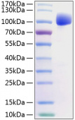 Active Recombinant Human FGFR-2/KGFR/CD332 Protein (RP01213)